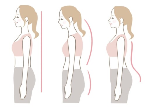 猫背姿勢と反り腰
